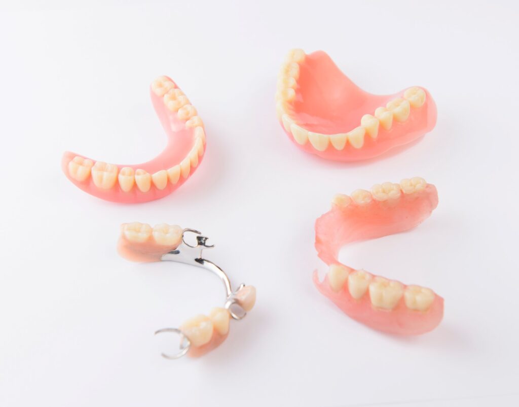 Regaining Confidence: The Comprehensive Guide to Fixed Partial Dentures